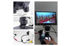 China A33.0211 Digital LCD Microscope LCD Microcirculation Checking Microscope supplier