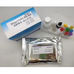 Medical Diagnostic Ca19-9 Elisa Test Kit Antigen Immunoassay Sandwich for sale