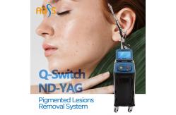China Skin Rejuvenation ND YAG Laser Machine  Q Switched 1064nm Carbon Laser Peel Machine supplier