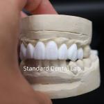 Dental crowns diagnostic wax-up High Esthetics From China Dental Lab for sale