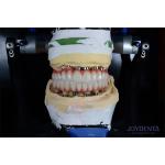 10mm Length Single Tooth Implant Gamma Irradiated For Optimal Surgical Outcomes for sale