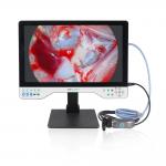 Laparoscopy Cystoscope Surgeries 24 HD Endoscopy LED Light Source Endoscope Camera With Record Function for sale