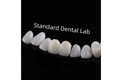 China High Esthetic Teeth Emax Laminate Veneers Incisal Translucency supplier
