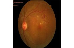 China Automated Retinal Fundus Camera Non Contact High Resolution supplier