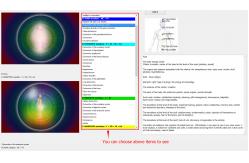 China 85% Accuracy 8D Nls Body Health Analyzer Advanced Quantum Magnetic Aura Chakra Machine supplier