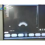 Siemens EC9-4 Compatible Ultrasound Transducer Endocavity Probe X300 System In Hospital