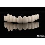 High Aesthetics Full Zirconia High Resistance To Corrosion And Wear For Demanding Applications for sale