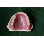 ISO13485 Conventional Denture Upper Acrylic Partial for sale