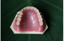 China ISO13485 Conventional Denture Upper Acrylic Partial supplier