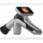 Portable Digital Fundus Camera with Ce Approval  (HA06) for sale