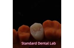 China High Esthetic BruxZir Full Contour Zirconia Crowns PFZ Bridge supplier
