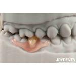 Flexible Denture Finish Personalized Customization and Advanced Tooth Arrangement Technology for Customized Needs for sale