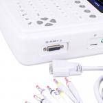 ISO Certificated Medical ECG Machine With 12 Channels