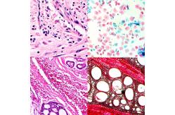 China LED 40-1000x Compound Optical Microscope A12.2603 Biological Research Trinocular Lab Microscope supplier