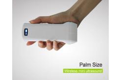 China Wireless Handheld 192 Elements Ultrasound Linear Probe of 5G newest supplier
