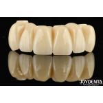 Dental Restoration Ti-Base Zirconia Hybrid Bridge Natural Looking Precise Fit for sale
