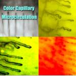 Hospital Nailfold Capillary Microscopy /  Microcirculation Microscope Multi Function for Medical for sale