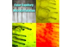 China Hospital Nailfold Capillary Microscopy /  Microcirculation Microscope Multi Function for Medical supplier