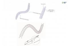 China Large Lumen Urethral Stent Hydrophobic Nitinol Design For Precision Placement supplier