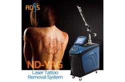 China Picosecond Tattoo Removal Machine  Q Switch Machine For Skin Rejuvenation supplier