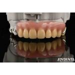 Elaborate Dental Stable Oral Structure  Framework Set Up Teeth Finish For Optimal Oral Health for sale