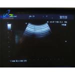 Aloka ASU-1010 Ultrasound Transducer Probe 4D And Cable Repair for sale