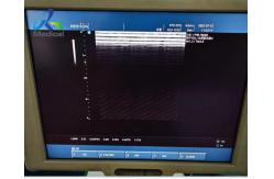 China Medison X6 Ultrasonic Board Repair Solutions Image Interference supplier