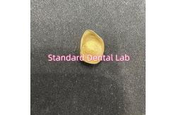 China Non Precious Yellow Metal Alloy Crown Full Cast With Zirconia Crown supplier