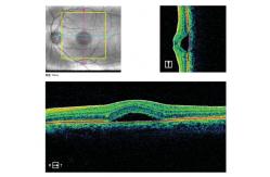 China Macular Disease Optical Coherence Tomography System PC Inside supplier