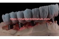 China Implant Supported Zirconia Bridge With Titanium Abutment High Esthetics supplier