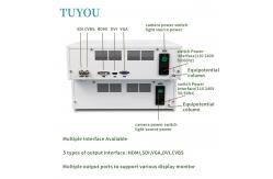 China Advanced 4-in-1 Endoscopic System Featuring Simultaneous Rigid and Flexible Imaging supplier