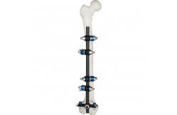 China Femur Tibial External Fixator supplier