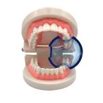 2021 New Dental Supply Plastic Disposable Lip Opener Intraoral Orthodontic Cheek Retractor Mouth Opener SE-U027/SE-U028 for sale