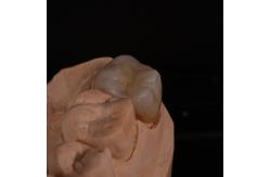 China Full Contour Translucent Zirconia Crown for Aesthetically Pleasing Results supplier
