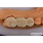 High Strength Dental Zirconia Your Ultimate Solution For Natural-looking Esthetics for sale