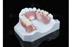 China Lightweight Valplast Flexible Partial With Excellent Retention In Pink And Meharry supplier