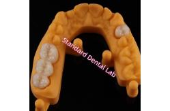 China Crown All Porcelain Ceramic Zirconia Ivoclar Esthetic Teeth OEM supplier