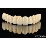Seamless Gradient Dental PMMA Multilayer Design For Natural Shade Transitions for sale