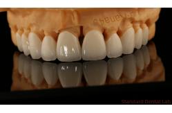 China Full Contour Dental Lab Crowns High Translucency Solid Zirconia Crown China Dental Lab supplier