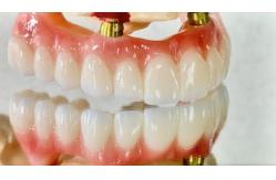 China Dental All On X Implant PFM Crown Titanium Fixed Hybrid Denture supplier