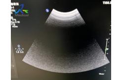 China  EPIQ 5 Ultrasound Machine Repair All Probe Images Are Abnormal Replace ACQ supplier