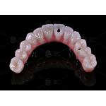 China Dental Lab Titanium Screw Retained Malong Design A1 Shade Full Arch Hybrid Bridge