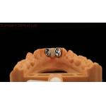 Dental PFM Maryland Bridge High Esthetics FDA Certified With Vita Porcelian China Dental Lab for sale