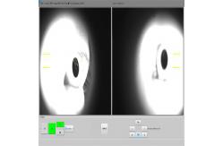 China SD Optical Coherence Tomography Machine Noninvasive Ophthalmic Imaging Diagnostic Techniques supplier
