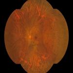176 Deg Wide Angle Fundus Camera With One Key Operation And Binocular Capture For Ophthalmic Medical Devices for sale