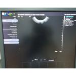 Wideband Micro Convex Endovaginal Ultrasound Probe Transducer Siemens S2000 EV-8C4