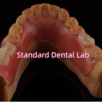 High Esthetic Flexible Valplast Partial Denture Easy To Clean for sale