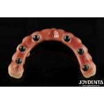 Adjustable Titanium Malong Hybrid Bridge Perfect Combination Of Traditional And Modern Techniques