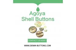 China Agoya Shell Buttons | Bulk Clothing Button supplier