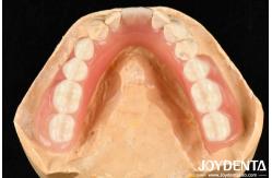 China Diverse And Lightweight Resin Material Acrylic Denture Finish supplier
